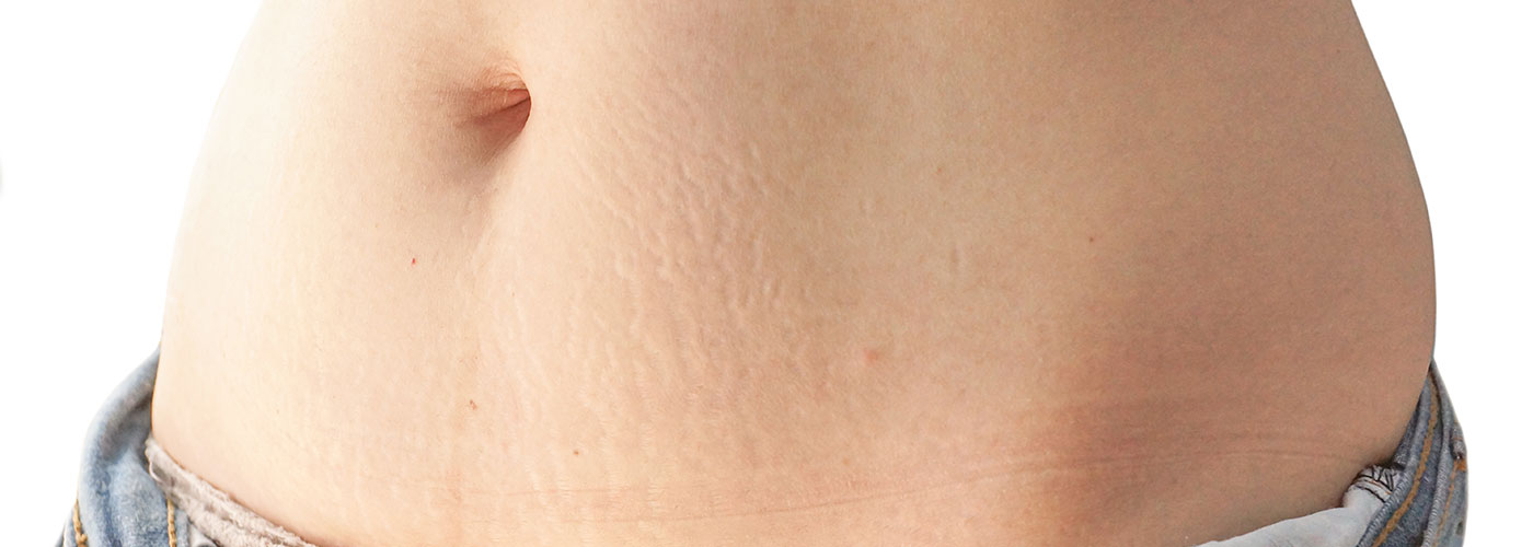 Din guide til Bio-Oil 